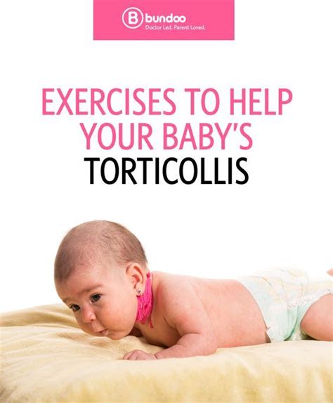Neck Stretches To Help With Torticollis Torticollis Baby Workout