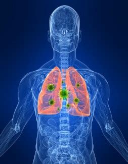 To infect a cell, the dengue virus initially binds to the cell surface. Pandemic flu can infect cells deep in the lungs, says new ...