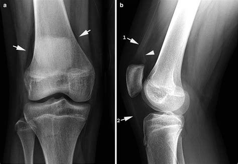 Knee And Leg Radiology Key