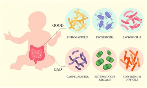 Gut Microbiome And The Risk Of Celiac Disease Dna In The News