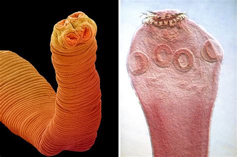 Man Dies After Getting Crazy Cancer From Killer Tapeworm Living