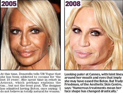 How Donatella Versace Transformed Herself Into A Human Waxwork With