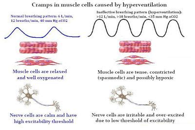 In short, if you're a mesomorph, you have a natural. MYO Therapy & Healthcare Institute: muscle cramp symptoms and treatment