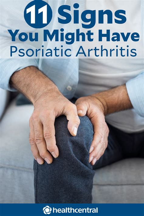 11 Signs You Might Have Psoriatic Arthritis Psoriatic Arthritis
