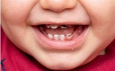 Baby teeth development and toddler teeth - Blog
