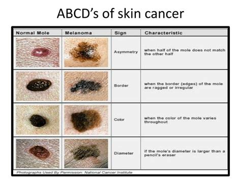 Ppt Skin Colour And Its Reaction To Light Melanocyte And Their Role