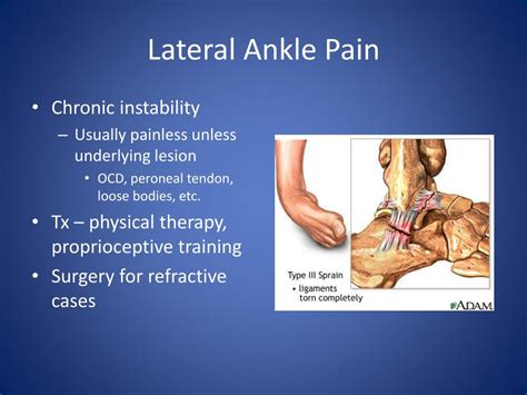 Ppt Chronic Ankle Pain Powerpoint Presentation Free Download Id