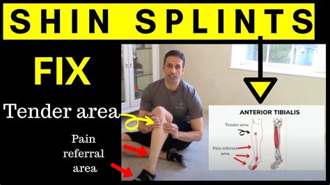 Fast Shin Splints Cure Exercise Youtube