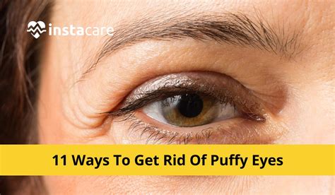 11 Ways To Get Rid Of Puffy Eyes