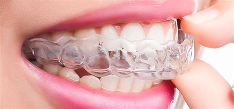 Harga cuci gigi di klinik swasta adalah lebih kurang rm70.00 hingga ke rm150.00 bergantung kepada tahap kekotoran gigi. Pasang Behel / Kawat Gigi di Klinik Gigi Joy Dental ...