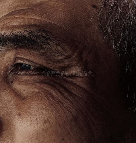 Age Spots Forehead Stock Photos Free And Royalty Free Stock Photos From
