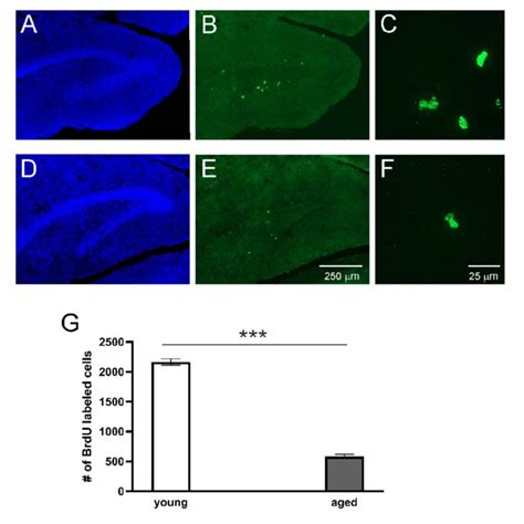 Proliferation Of Cells In The Dg Of Adult Opossums Confocal Images