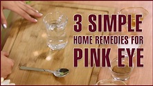 3 Simple Natural Home Remedies For PINK EYE TREATMENT - YouTube