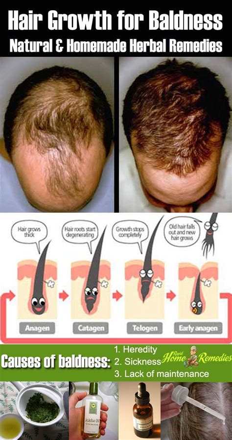 How To Overcome Baldness Naturally Tips And Hair Care The Definitive