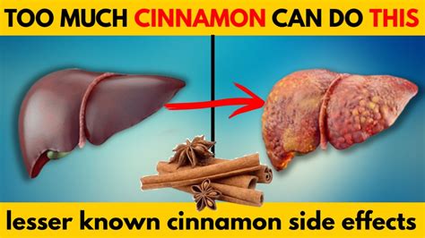 6 Lesser Known Side Effects Of Cinnamon Youtube
