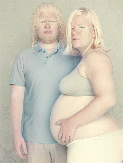 Best Images About Albinos On Pinterest Portrait Portrait