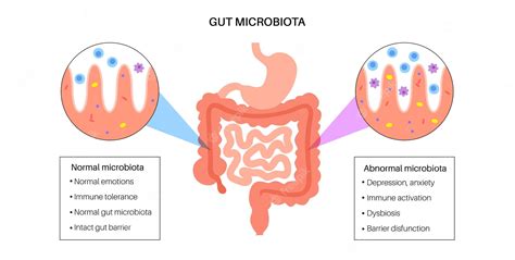 Premium Vector Gut Brain Connection Dysbiosis And Microbiome Normal