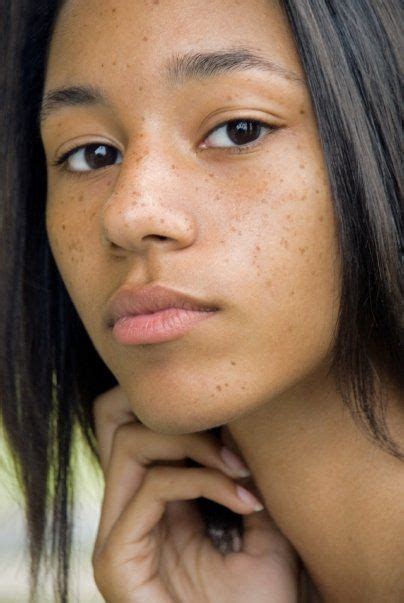 Freckles Freckles Brown Spots Removal Pretty Black Girls