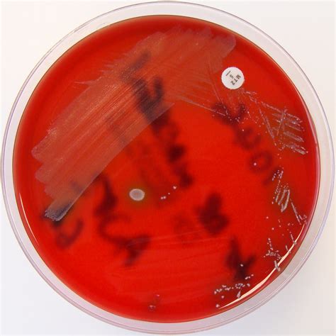 Propionibacterium Propionicum On Columbia Horse Blood Agar A Photo On