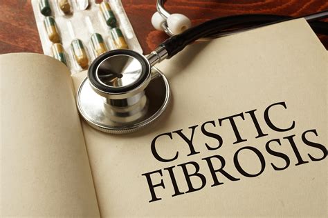 History Of Cystic Fibrosis Rare Disease Advisor