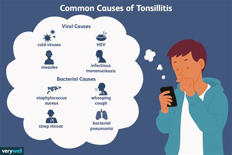 Causes Diagnosis And Treatment Of Tonsillitis