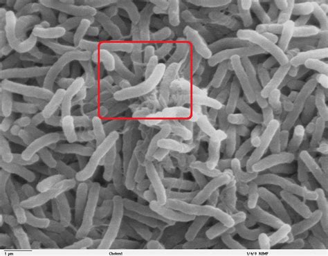 Vibrio Cholerae Scheda Batteriologica Ed Approfondimenti