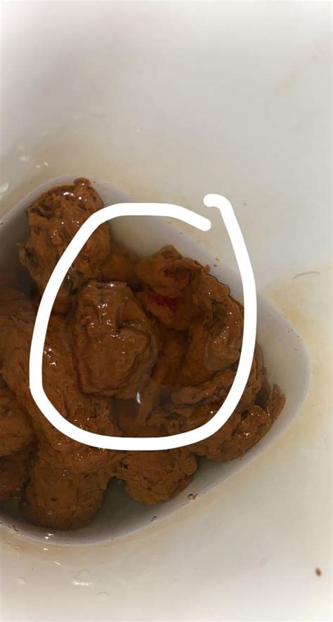 Bright Red Blood On Stool Any Ideas What Could It Be Rpoop