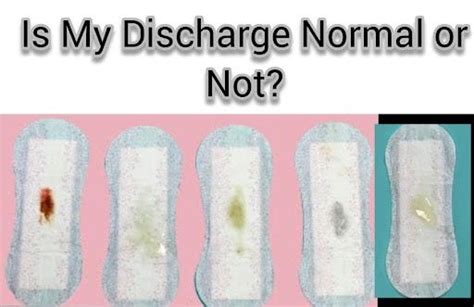 5 Colours Of Vaginal Discharge And Their Meanings By Rachel Richard
