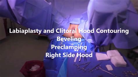 Labiaplasty And Clitoral Hood Contouring Demo Youtube