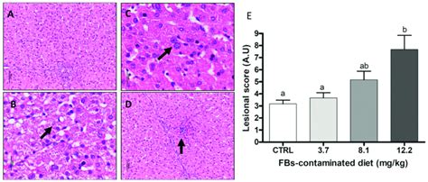 Histological Aspects Of Liver Of Pigs Submitted To Different