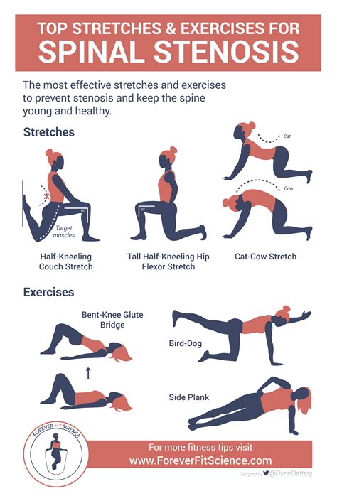 Exercises To Help With Spinal Stenosis Exercise Poster