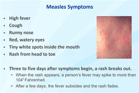 Public Health Officer No Confirmed Cases Of Measles In Douglas County