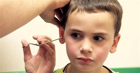 An Object Or Insect In The Ear — Know Some Other Types Of Ear