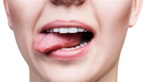 ¿conoces El Síndrome De La Boca Seca Clínica Dental Dr M López De