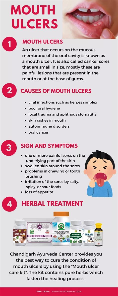 Ppt Mouth Ulcers Causes Symptoms And Herbal Treatment Powerpoint