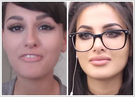 Lia Sssniperwolf Before Plastic Surgery