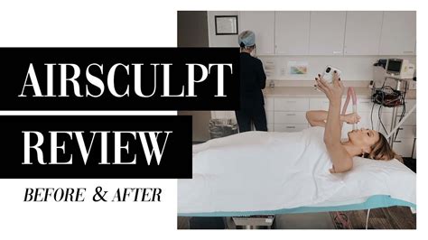5 month airsculpt review before and after youtube