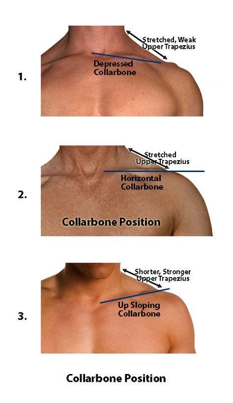 Pin On Shoulder Injuries And Rehabilitation