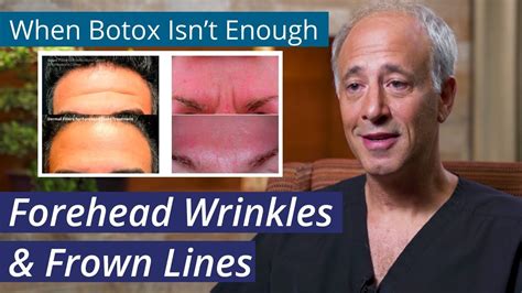 Treating Forehead Wrinkles How To Get Rid Of Stubborn Foreheadlines