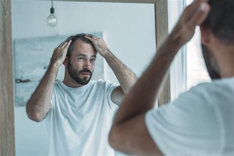 Hair Loss In Men Common Causes And Effective Treatments Evexias
