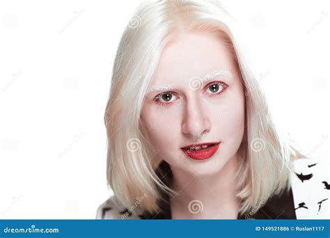 Sexy Albino Girls Telegraph