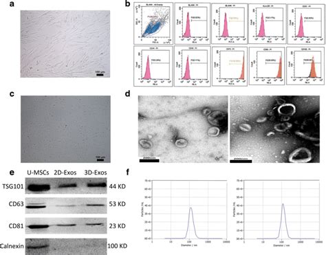 Characterization Of U MSCs And Exosomes A Morphological Observation Of