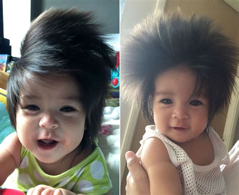 Baby Born With Most Hair