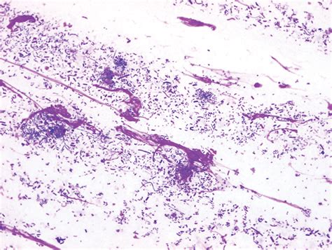 Skin Fold Dermatitis Intertrigo In Dogs Todays Veterinary Practice