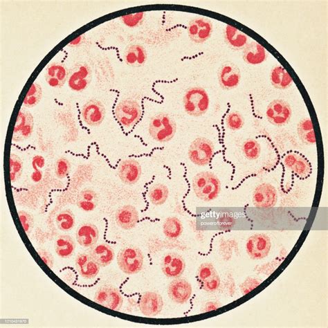 Microscopic View Of Human Blood Cells And Streptococcus Pyogenes