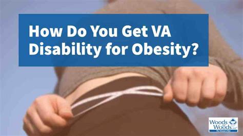 The Roundabout Way To Get Va Disability For Obesity