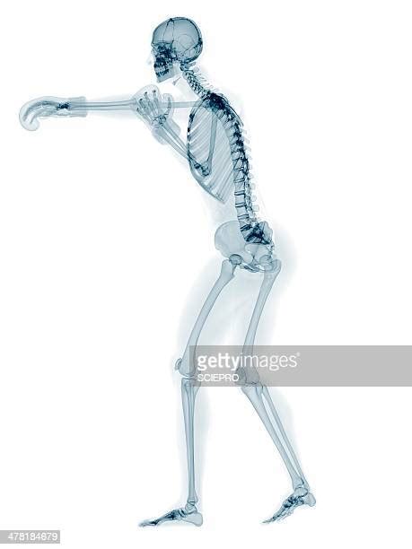 Human Skeletons Action Photos And Premium High Res Pictures Getty Images