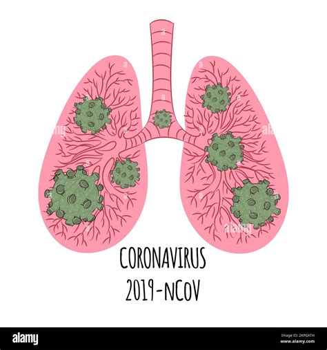 Pneumonia Green Bacteria In Pink Lungs Human Body Coronavirus Pandemic
