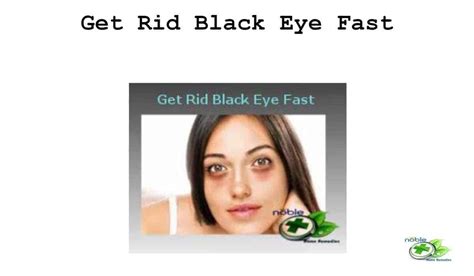 how to get rid of a black eye 10 best home remedies