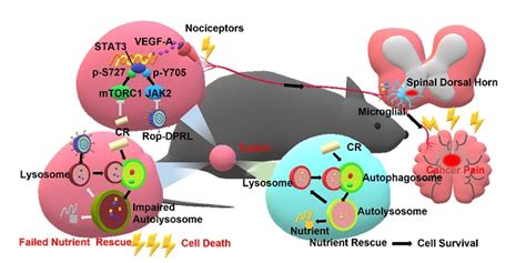 Combination Therapy With Ropivacaine Loaded Liposomes And Nutrient